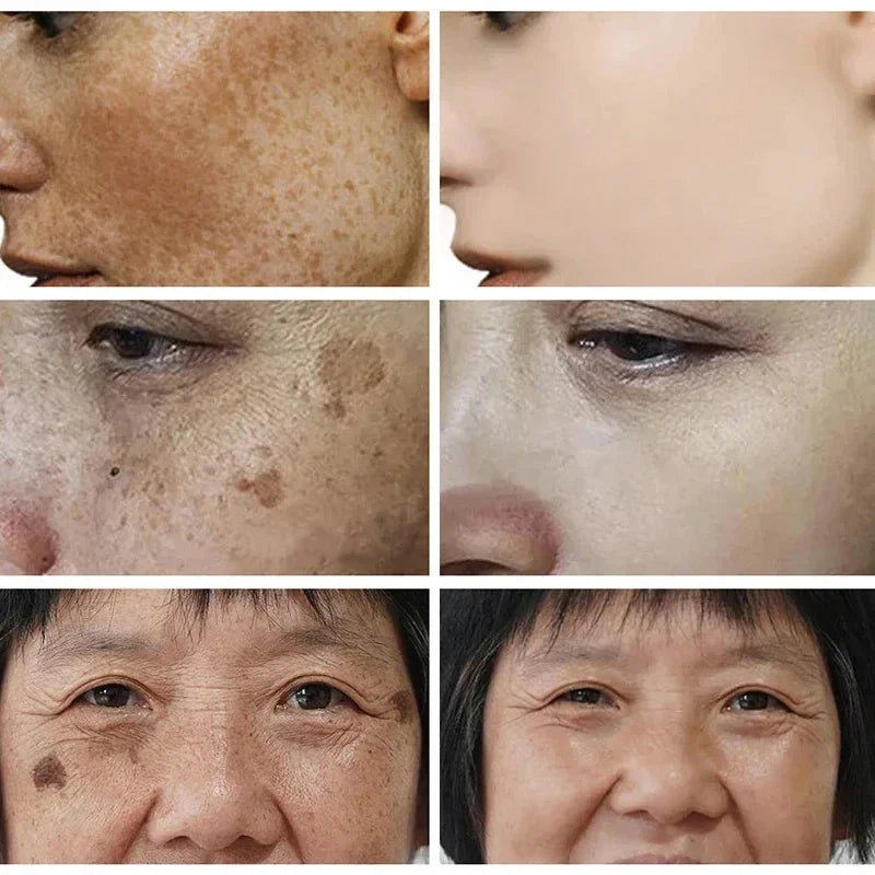 Niacinamide Face Lightening Cream