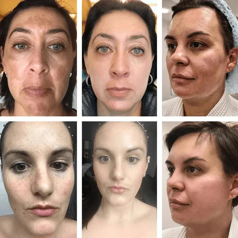 Niacinamide Face Lightening Cream